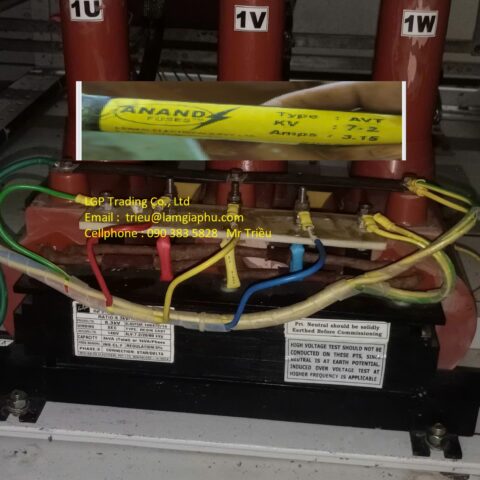ANAND FGCT2000011